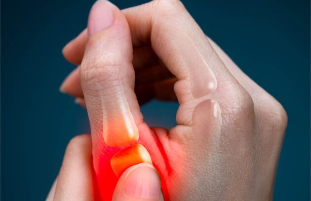 arthritis in thumb